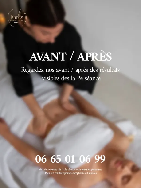Résultat Amincissement Avant Après 3